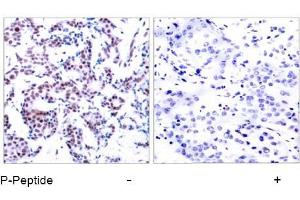 Image no. 1 for anti-Jun B Proto-Oncogene (JUNB) (pSer259) antibody (ABIN196658) (JunB Antikörper  (pSer259))