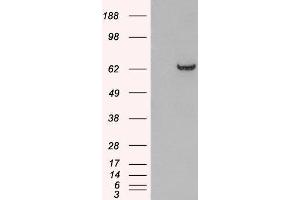 HEK293 overexpressing GRB7 and probed with ABIN2562933 (mock transfection in first lane). (GRB7 Antikörper  (N-Term))