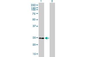 Western Blot analysis of DGCR6 expression in transfected 293T cell line by DGCR6 MaxPab polyclonal antibody. (DGCR6 Antikörper  (AA 1-220))