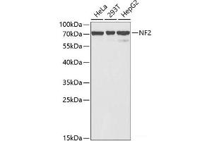 Western blot analysis of extracts of various cell lines using NF2 Polyclonal Antibody at dilution of 1:1000. (Merlin Antikörper)