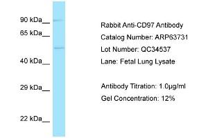 Western Blotting (WB) image for anti-CD97 (CD97) (C-Term) antibody (ABIN970353) (CD97 Antikörper  (C-Term))