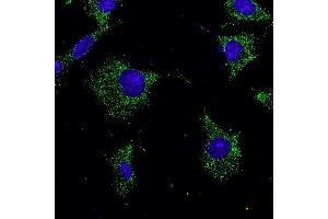 Immunofluorescence -anti-Rab7a Ab in Hepa1-6 cells at 1/50 dilution, cells were fixed With methanol,