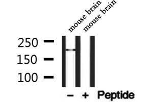 Western blot analysis of extracts from mouse brain, using TRPM2 Antibody.