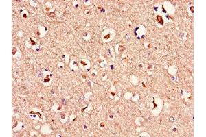 Immunohistochemistry of paraffin-embedded human brain tissue using ABIN7159976 at dilution of 1:100 (ERK2 Antikörper  (AA 133-316))