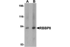 Western blot analysis of RBBP8 in mouse spleen tissue lysate with RBBP8 antibody at (A) 1 and (B) 2 μg/ml. (Retinoblastoma Binding Protein 8 Antikörper  (Center))