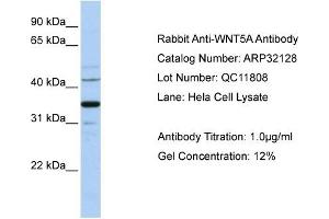 WNT5A antibody used at 1 ug/ml to detect target protein. (WNT5A Antikörper  (Middle Region))