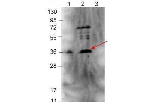 Western blot showing detection of 0. (p39 Antikörper)
