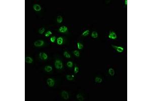 Immunofluorescence staining of Hela cells with ABIN7127714 at 1:100,counter-stained with DAPI. (Rekombinanter MTOR Antikörper  (pSer2448))