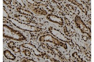 ABIN6263791 and ABIN6273277 at 1/100 staining Human kidney tissue by IHC-P.