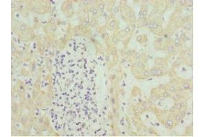 Immunohistochemistry of paraffin-embedded human liver tissue using ABIN7155995 at dilution of 1:100 (HMGCL Antikörper  (AA 1-325))