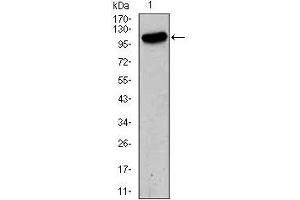 GRIA2 Antikörper  (AA 652-807)