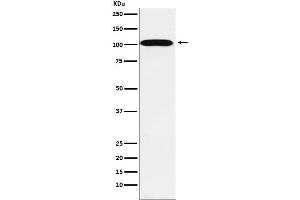 Western blot analysis of ATP1A2 expression in Human fetal heart lysate.