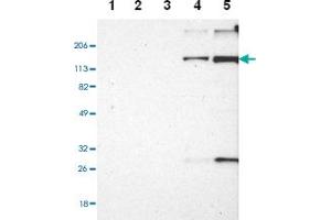 Western blot anyalysis of Lane 1: Human cell line RT-4, Lane 2: Human cell line U-251MG sp, Lane 3: Human cell line A-431, Lane 4: Human liver tissue, Lane 5: Human tonsil tissue with EMILIN1 polyclonal antibody . (Emilin1 Antikörper)