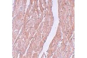 Immunohistochemistry (IHC) image for anti-MYC Induced Nuclear Antigen (MINA) (N-Term) antibody (ABIN1031457)