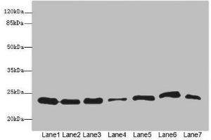 Western blot All lanes: PSMB3 antibody at 3. (PSMB3 Antikörper  (AA 1-205))