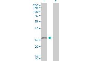Western Blotting (WB) image for anti-Tumor Necrosis Factor Receptor Superfamily, Member 13C (TNFRSF13C) (AA 1-184) antibody (ABIN530345)