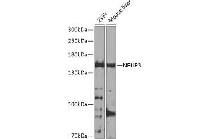 Western blot analysis of extracts of various cell lines, using NPHP3 antibody (ABIN6132967, ABIN6144770, ABIN6144771 and ABIN6224683) at 1:1000 dilution. (NPHP3 Antikörper  (AA 1-130))
