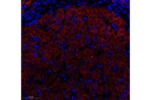 Immunofluorescence (Paraffin-embedded Sections) (IF (p)) image for anti-Heat Shock 60kDa Protein 1 (Chaperonin) (HSPD1) antibody (ABIN7074167)