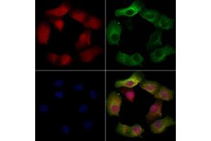 ABIN6257466 and ABIN6274772 staining Hela cells by IF/ICC. (RPL19 Antikörper  (C-Term))