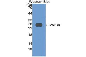 Western blot analysis of the recombinant protein. (CASP5 Antikörper  (AA 145-327))