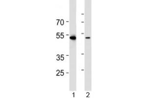 Western blot analysis of lysate from 1) HL-60 and 2) Jurkat cell line using RUNX3 antibody at 1:1000. (RUNX3 Antikörper  (AA 168-197))