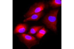 Immunofluorescenitrocellulosee of human A549 cells stained with Hoechst 33342 (Blue) and monoclonal anti-human FUS2 antibody (1:500) with Texas Red (red).
