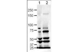 Western blot using  Affinity Purified anti-SLIT-1 antibody shows detection of SLIT-1 in rat (lane 1) and mouse (lane 2) brain lysates.