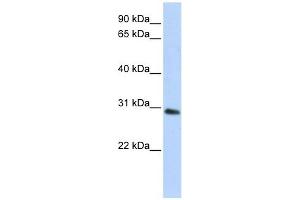 BPGM antibody used at 1 ug/ml to detect target protein. (BPGM Antikörper  (C-Term))