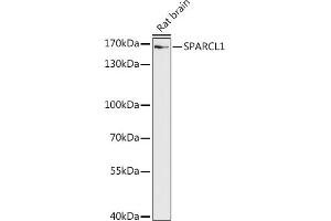 Western blot analysis of extracts of Rat brain, using SP antibody (ABIN7270512) at 1:1000 dilution. (SPARCL1 Antikörper  (AA 17-300))