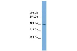 WB Suggested Anti-Tmem130 Antibody Titration:  0. (TMEM130 Antikörper  (Middle Region))