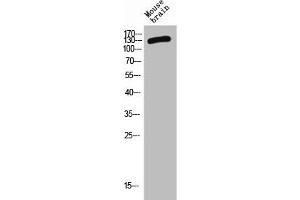 Western Blot analysis of MOUSE-BRAIN cells using CD101 Polyclonal Antibody (CD11 Antikörper  (Internal Region))