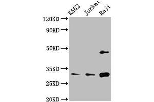Western Blot Positive WB detected in: K562 whole cell lysate, Jurkat whole cell lysate, Raji whole cell lysate All lanes: CCND3 antibody at 3. (Cyclin D3 Antikörper  (AA 1-292))