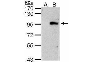 WB Image Western Blot analysis of ECEL1 expression in transfected 293T cell line by ECEL1 polyclonal antibody. (ECEL1 Antikörper)