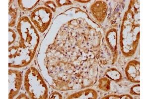 IHC image of ABIN7127689 diluted at 1:100 and staining in paraffin-embedded human kidney tissue performed on a Leica BondTM system. (Rekombinanter EIF2AK2 Antikörper  (pThr446))