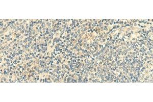 Immunohistochemistry of paraffin-embedded Human tonsil tissue using CLEC10A Polyclonal Antibody at dilution of 1:50(x200) (CLEC10A Antikörper)