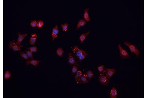 ABIN6266901 staining MCF-7 cells by IF/ICC. (FHIT Antikörper  (Internal Region))