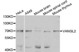 Western blot analysis of extracts of various cell lines, using VANGL2 antibody. (VANGL2 Antikörper)