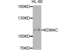 Western blot analysis of extracts of HL-60 cells, using KDM4C antibody. (KDM4C Antikörper)