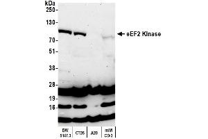 Western Blotting (WB) image for anti-Eukaryotic Elongation Factor-2 Kinase (EEF2K) (AA 675-725) antibody (ABIN7454537) (EEF2K Antikörper  (AA 675-725))