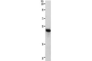 Gel: 10 % SDS-PAGE, Lysate: 40 μg, Lane: Human liver cancer tissue, Primary antibody: ABIN7190220(CERS2 Antibody) at dilution 1/750, Secondary antibody: Goat anti rabbit IgG at 1/8000 dilution, Exposure time: 40 seconds (Ceramide Synthase 2 Antikörper)