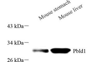 Western blot analysis of PBLD (ABIN7075030),at dilution of 1: 2000 (PBLD1 Antikörper)