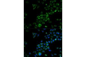 Immunofluorescence analysis of HeLa cells using TRAF3 antibody. (TRAF3 Antikörper)