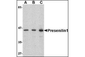 Western blot analysis of presenilin1 in human brain lysate with this product at (A) 0. (Presenilin 1 Antikörper  (C-Term))