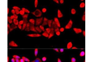 Immunofluorescence analysis of HeLa cells using RPL8 Polyclonal Antibody at dilution of 1:100 (40x lens). (RPL8 Antikörper)