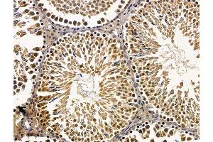 ABIN7096468 and ABIN7100532 at 1/100 staining rat testis tissue by IHC-P. (Znf423 Antikörper)
