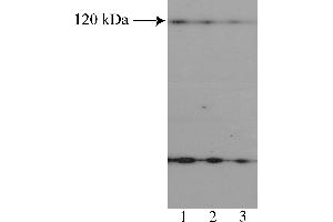 Western Blotting (WB) image for anti-Nuclear Factor of Activated T-Cells, Cytoplasmic, Calcineurin-Dependent 2 (NFAT1) (AA 433-567) antibody (ABIN967558) (NFAT1 Antikörper  (AA 433-567))