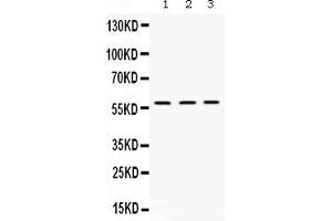 Western blot analysis of XIAP expression in rat kidney extract ( Lane 1), mouse liver extract ( Lane 2) and HELA whole cell lysates ( Lane 3). (XIAP Antikörper  (AA 15-244))