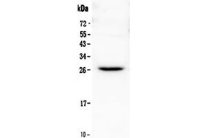 Western blot analysis of Flt3 ligand using anti-Flt3 ligand antibody . (FLT3LG Antikörper  (AA 28-189))