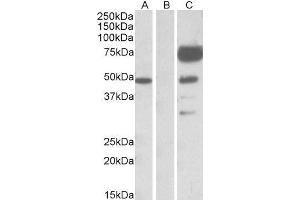 HEK293 lysate (10ug protein in RIPA buffer) overexpressing Human ANGPT1 with DYKDDDDK tag probed with ABIN2561113 (1ug/ml) in Lane A and probed with anti- DYKDDDDK Tag (1/1000) in lane C. (Angiopoietin 1 Antikörper  (Internal Region))
