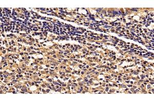 Detection of IL2Rg in Human Appendix Tissue using Polyclonal Antibody to Interleukin 2 Receptor Gamma (IL2Rg) (IL2RG Antikörper  (AA 23-262))